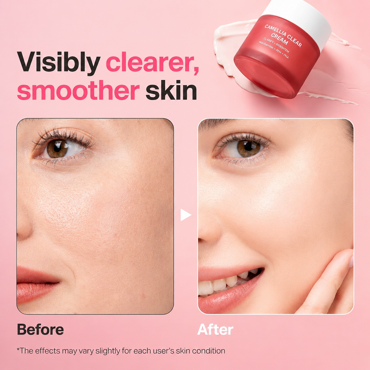5% Niacinamide + Korean Botanical Skincare + Gentle Pore Refining